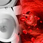nguyên nhân tiểu ra máu ở nam giới