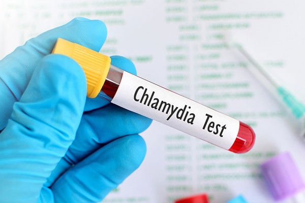 Cách điều trị bệnh Chlamydia hiệu quả